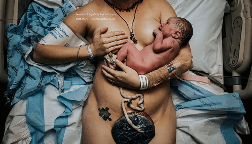 amamentação após o parto -bebê com cordão umbilical e placenta