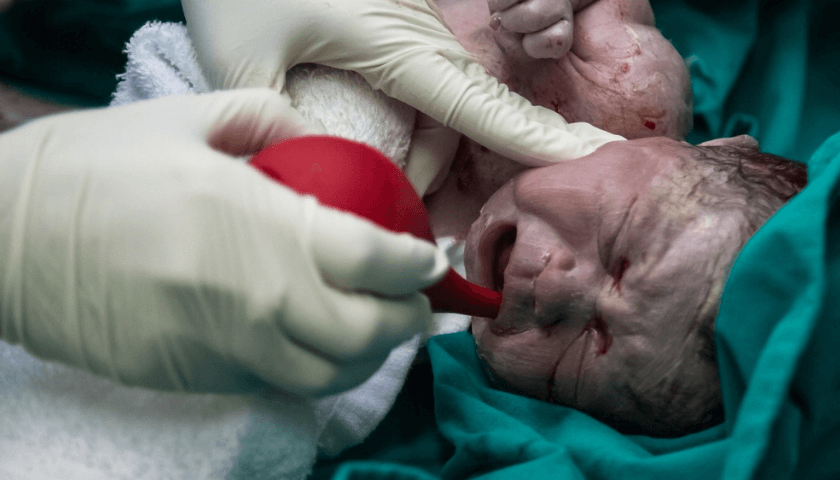Tipos de parto - fotografias de parto-Recém nascido