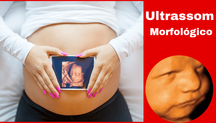 ultrassom morfológico-ultrassom morfologica-pré natal gravidez