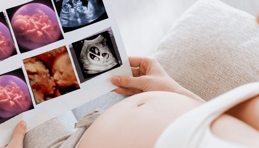 ultrassom-ultrassom obstetrico-ultrassom com doppler

