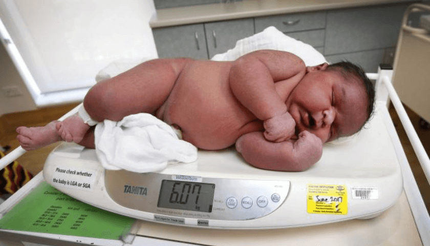  Bebê macrossômico, nasce de parto normal, sem anestesia
