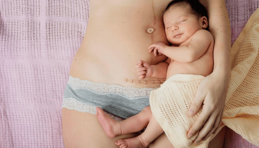 recuperação pós parto cesárea-mamãe e bebê