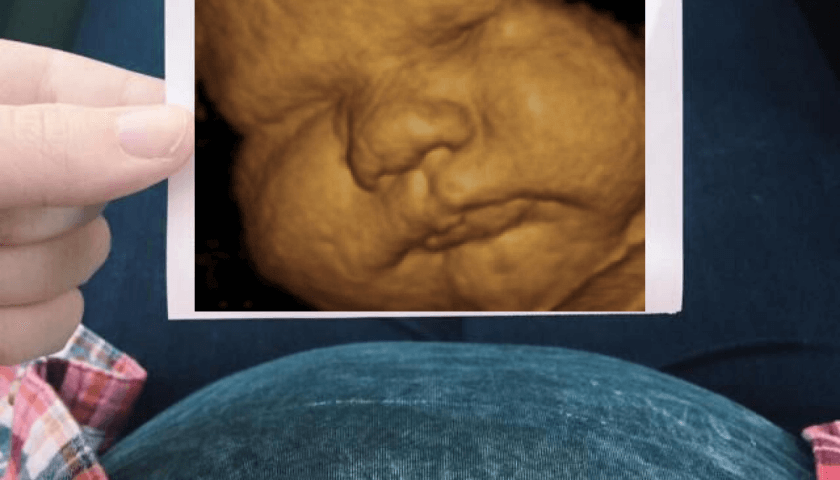ultrassom gravidez, desenvolvimento do bebê