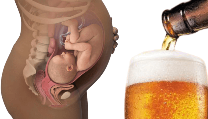 cuidados na gravidez, síndrome Alcoólica Fetal