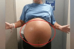 Mulher em trabalho de parto, tem bebê gigante, e tem parto normal