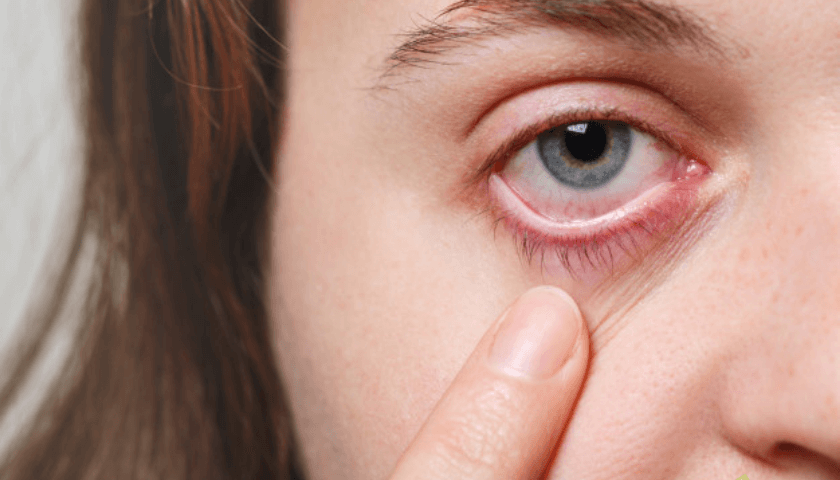 Irritação nos olhos na gravidez